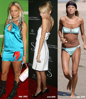 nicole richie before and after weight loss